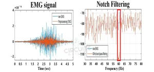 Why Is Notch Filter Used for EMG